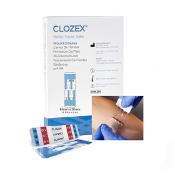 Clozex Clozex Medical CL1040L-Skin Closure Device Clozex 1-1/2 X 2 Inch Polyurethane, Polyester, Med