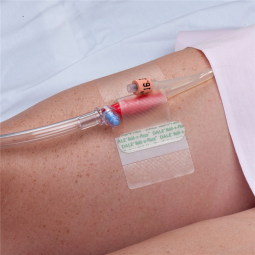 Hold-n-Place Dale Medical Products 150-Dale Hold-n-Place Catheter Holder, Urinary Accessories