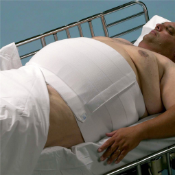 Dale Dale Medical Products 818-Abdominal Binder Dale Hook & Loop Closure 60 to 75 Inch Waist Circumf